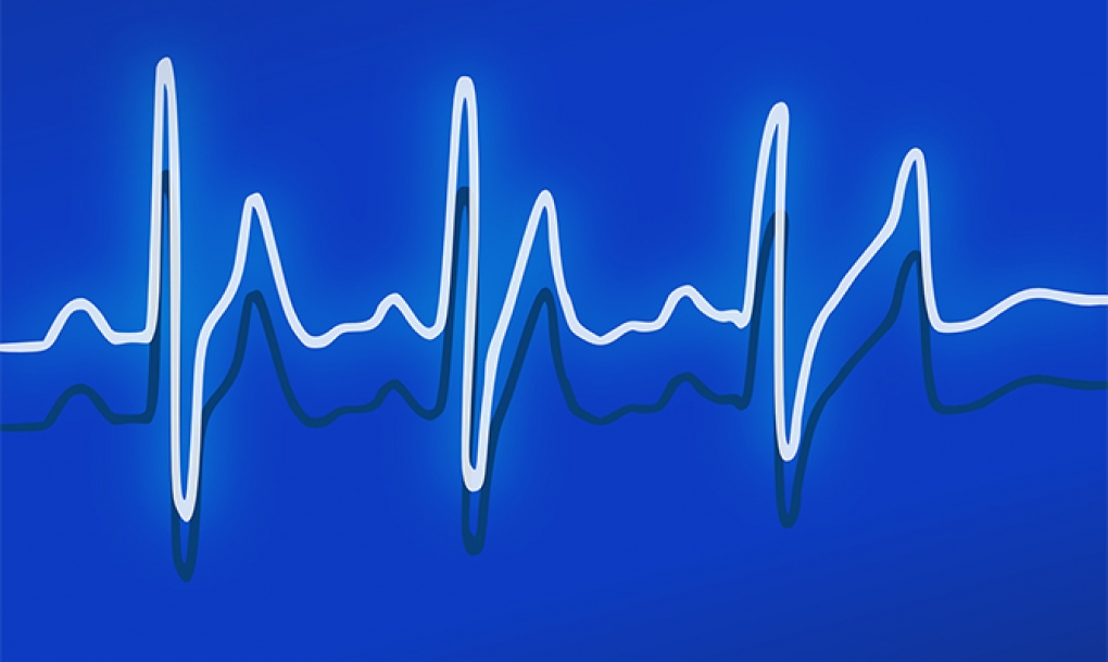 Una calculadora mide el riesgo de ingreso por insuficiencia cardiaca a un mes y a un año en pacientes ambulatorios