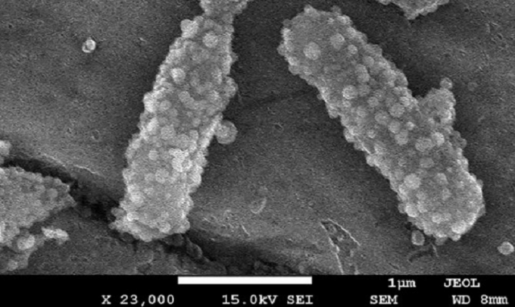 Utilizan bacterias para transportar nanopartículas cargadas con fármacos dirigidos a tumores de difícil acceso