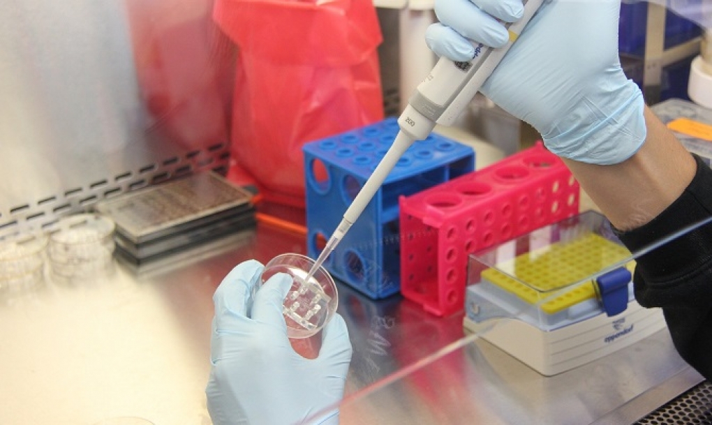 Test celular para identificar una enfermedad rara muy grave pero tratable