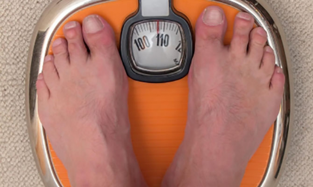 Cumplir las pautas de alimentación es clave para una pérdida de peso significativa tras la cirugía de la obesidad