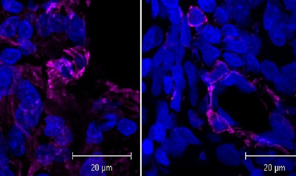 Una nueva terapia utiliza nanopartículas contra la fibrosis pulmonar