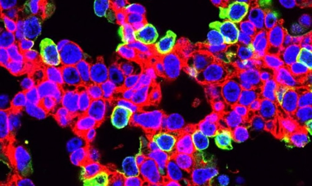 Nueva terapia con CRISPR para ‘curar’ una enfermedad pulmonar mortal
