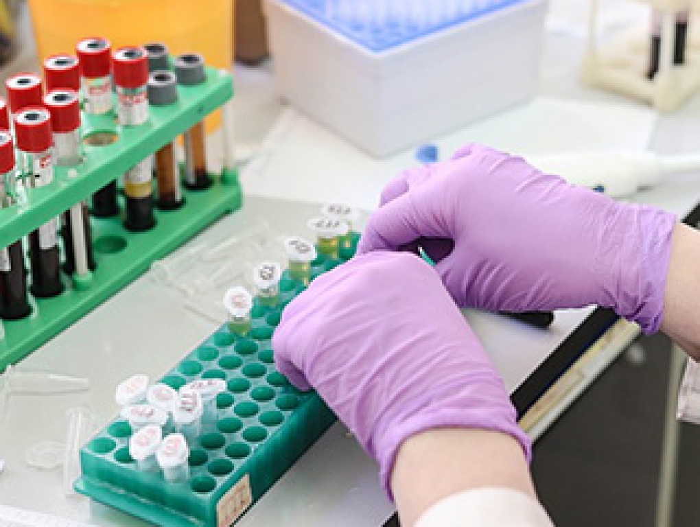 Por un nuevo modelo de Salud Pública en Castilla y León