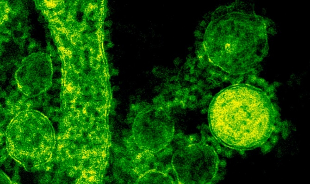 En busca de la producción ultrarrápida de anticuerpos neutralizantes del SARS-CoV-2