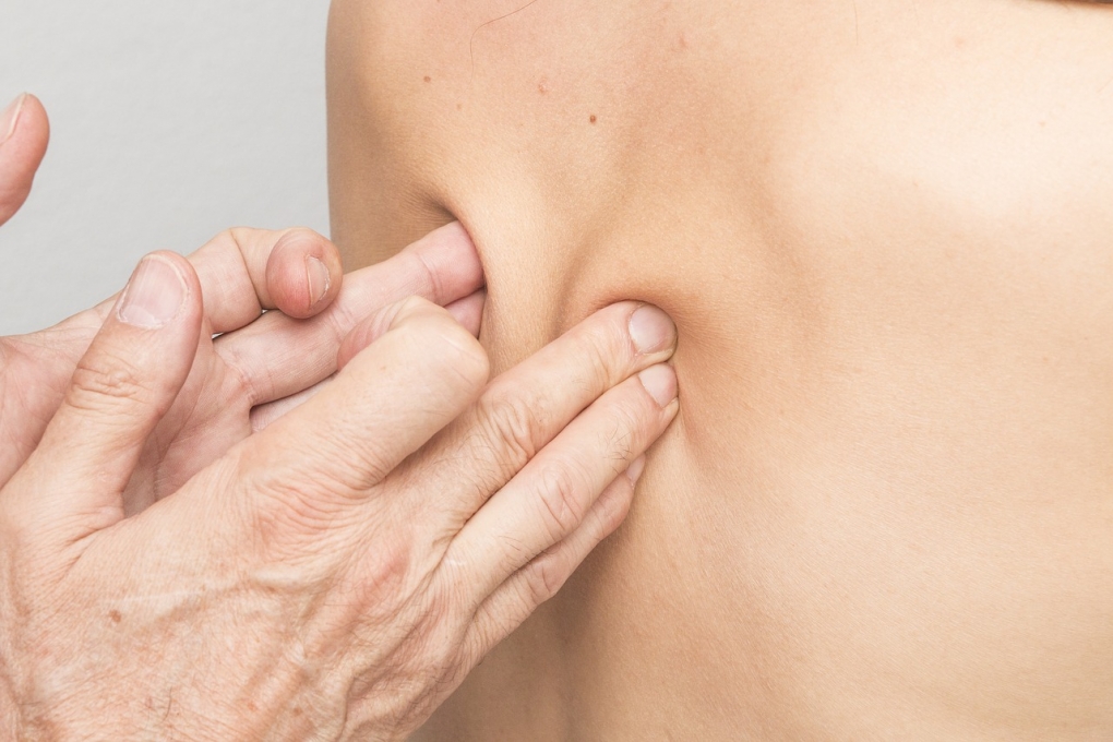 La espondilitis anquilosante, mucho más que un dolor de espalda