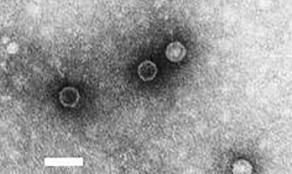 Nuevos avances para combatir las enfermedades por enterovirus
