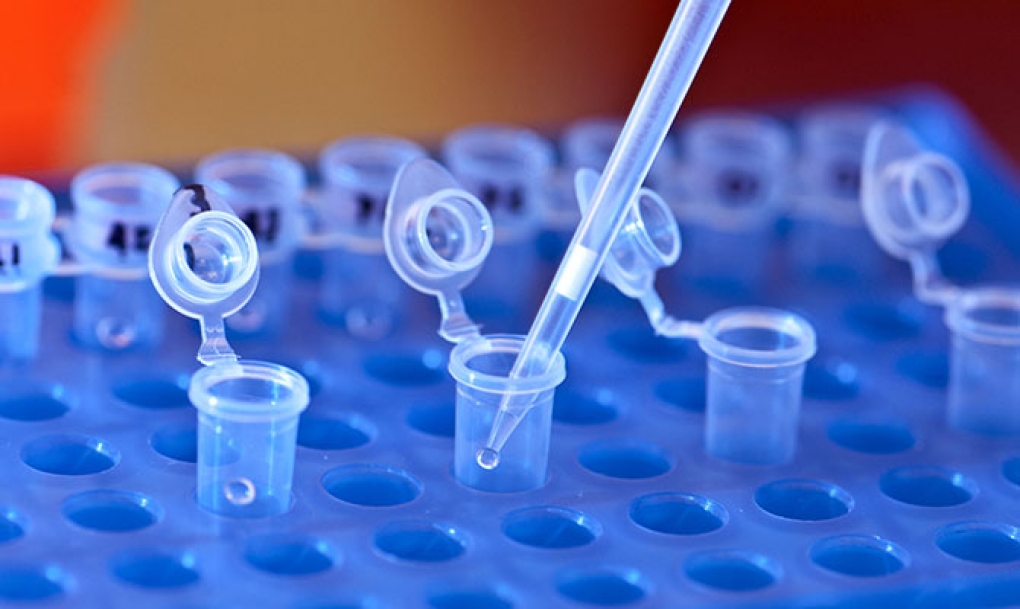 Mutaciones en el gen BRCA2 aumentan el riesgo de sufrir trombos