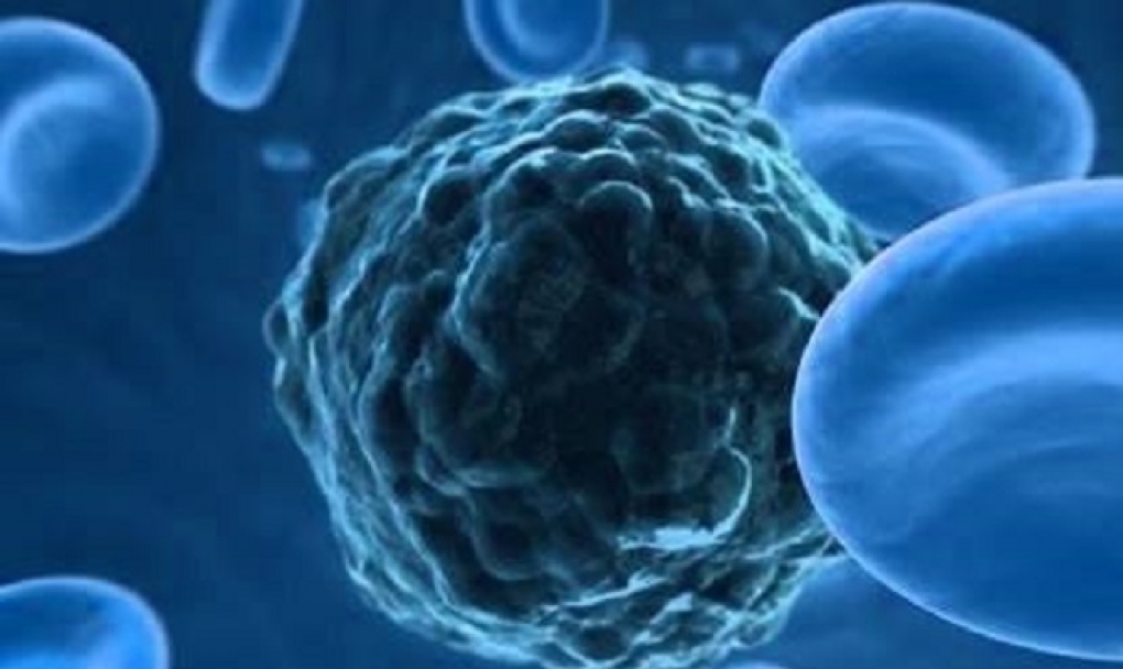 En 2020 habrá casi 18.000 nuevos casos de neoplasias linfoides en España