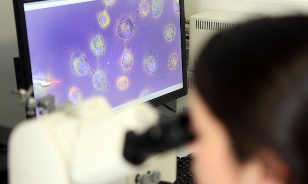 Nuevos marcadores para predecir el avance del cáncer, y nanotecnología para estudiar las metástasis