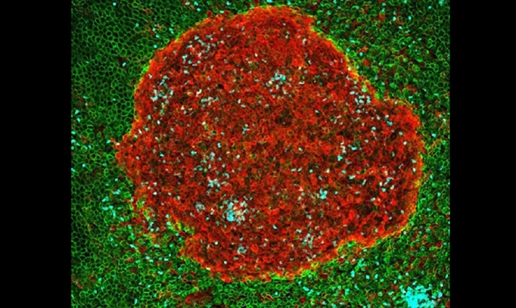 Científicos del CSIC identifican el mecanismo que activa la respuesta inmune frente a las infecciones abdominales