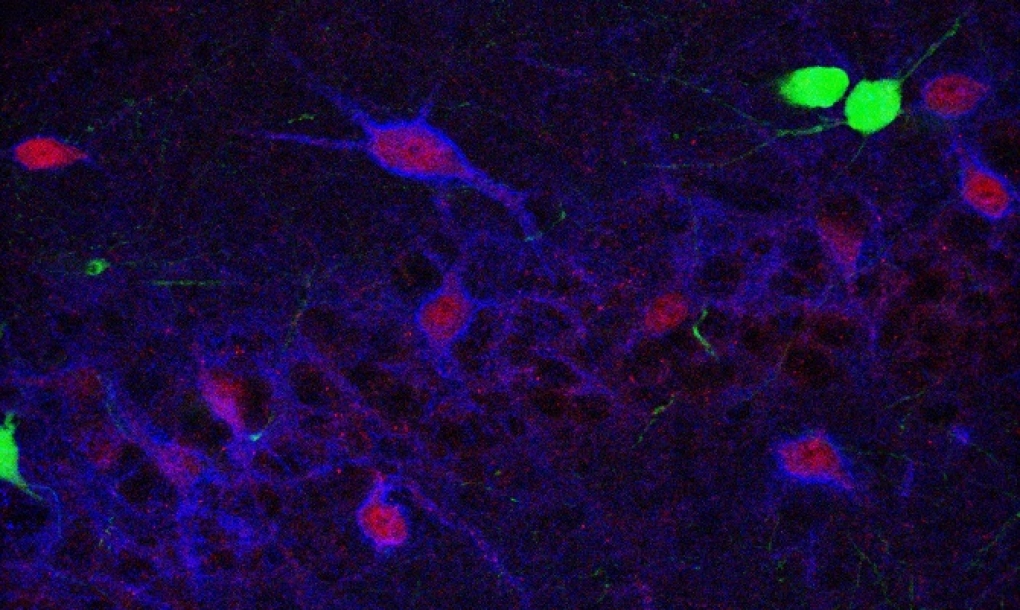 Nuevos datos acerca de las alteraciones del cerebro en enfermedades psiquiátricas