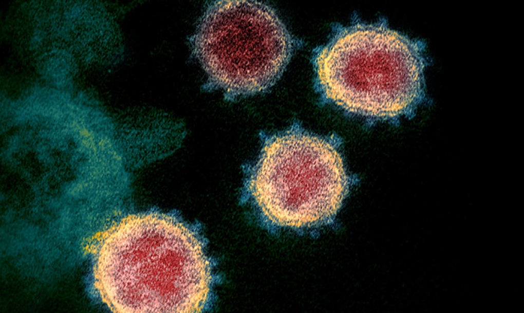 Cuatro nuevos casos en el País Vasco elevan a 83 el número de afectados por coronavirus en España | 1 de marzo
