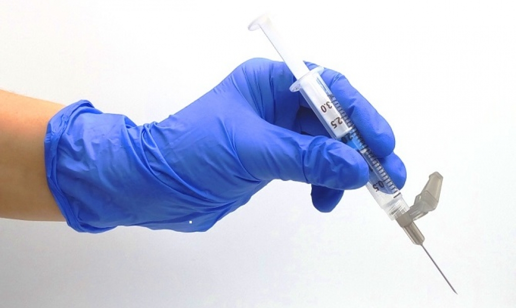 ¿Cuánto duele una extracción de sangre?