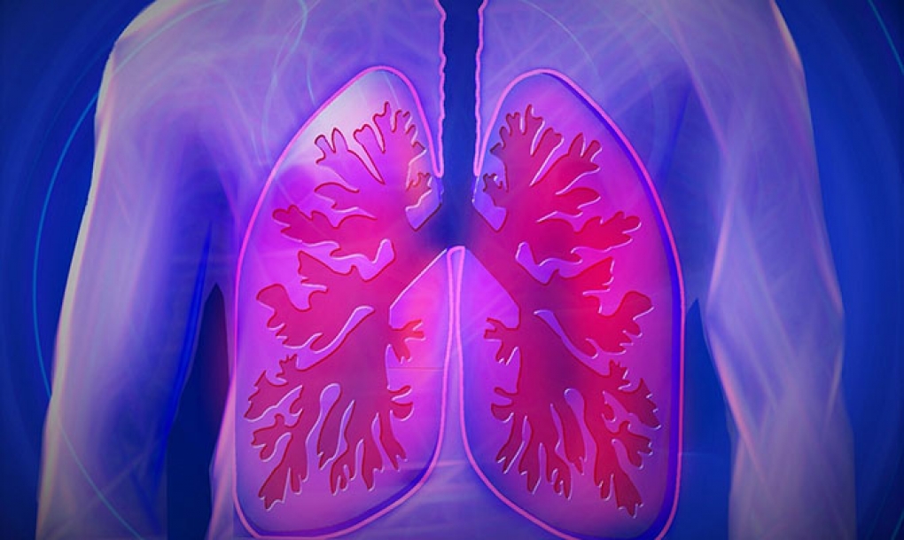 Los adultos jóvenes son el grupo con mayor incidencia de tuberculosis respiratoria