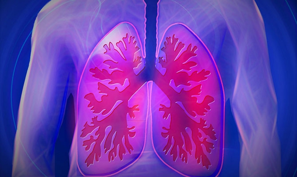 Los adultos j&oacute;venes son el grupo con mayor incidencia de tuberculosis respiratoria