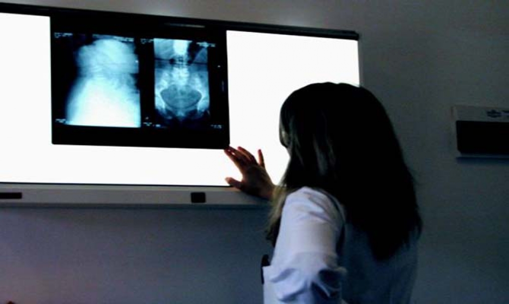 Sacyl reconoce la pérdida de 15.000 estudios radiológicos en el hospital de Ávila por un fallo en el sistema de almacenamiento