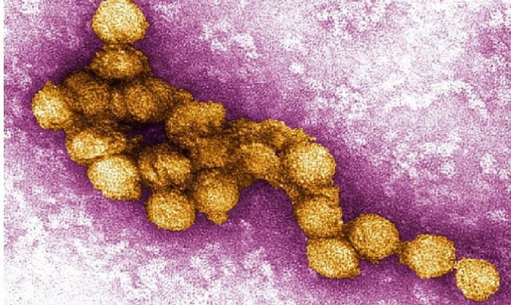 España sufre un aumento sin precedentes de casos del virus del Nilo Occidental