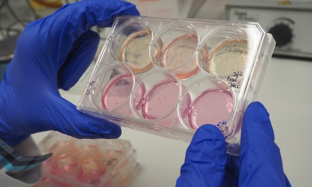 Investigadores del CSIC evaluarán la eficacia de un anticuerpo monoclonal sintético contra el cáncer