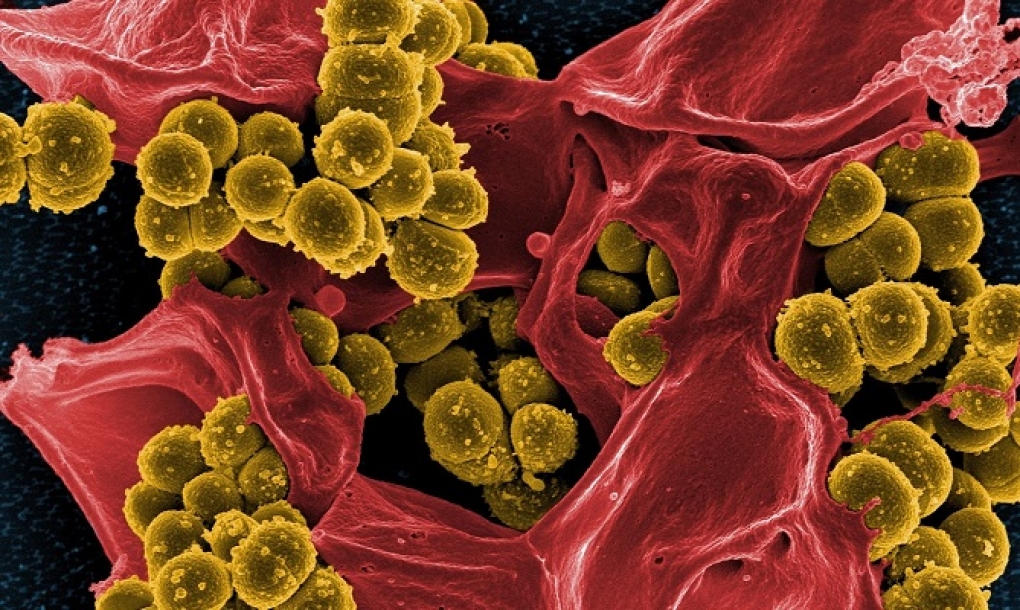 El microbioma intestinal protege frente a la predisposición genética a la leucemia