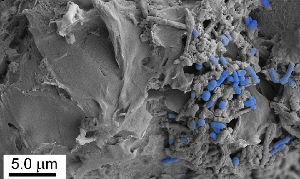 La ingesta de microplásticos altera la microbiota intestinal