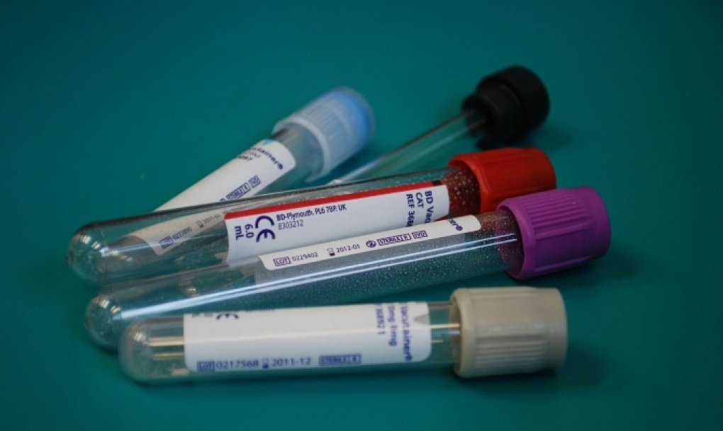 Las enfermeras recuerdan la importancia de hacerse la prueba del VIH para detener la transmisión del virus
