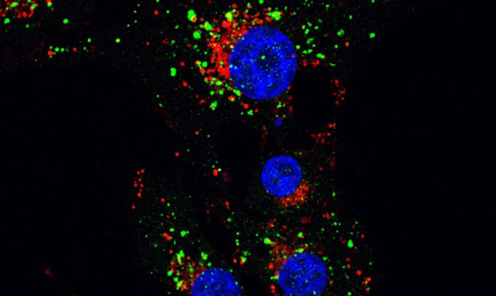 Un cannabinoide acaba con células tumorales gracias al ‘reciclaje’ celular