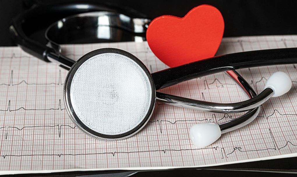 Las intervenciones coronarias percutáneas cayeron un 10% en 2020, situándose en niveles de cinco años atrás