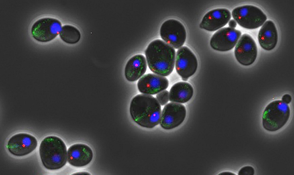 Un estudio del CSIC desvela un mecanismo clave en el envejecimiento prematuro de las células madre