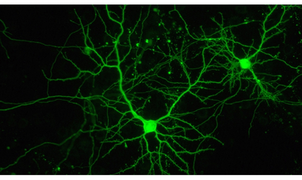 Una molécula regula la distribución de las neuronas inhibidoras en el cerebro