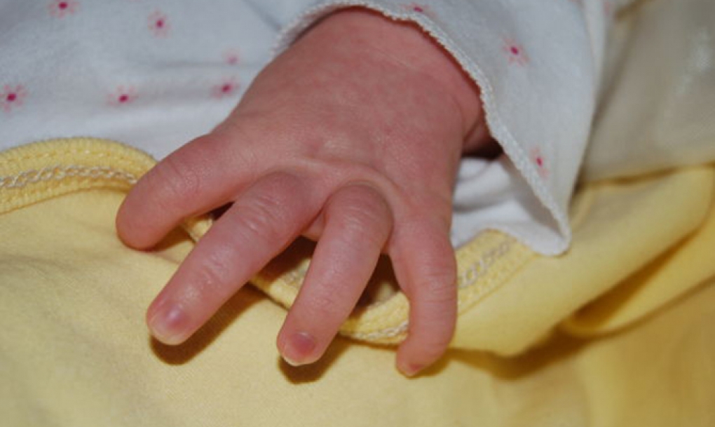 Nueva guía para familias de niños prematuros con displasia broncopulmonar