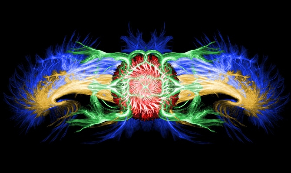 Un médico francés convierte en obras de arte las pruebas de resonancia magnética del cerebro