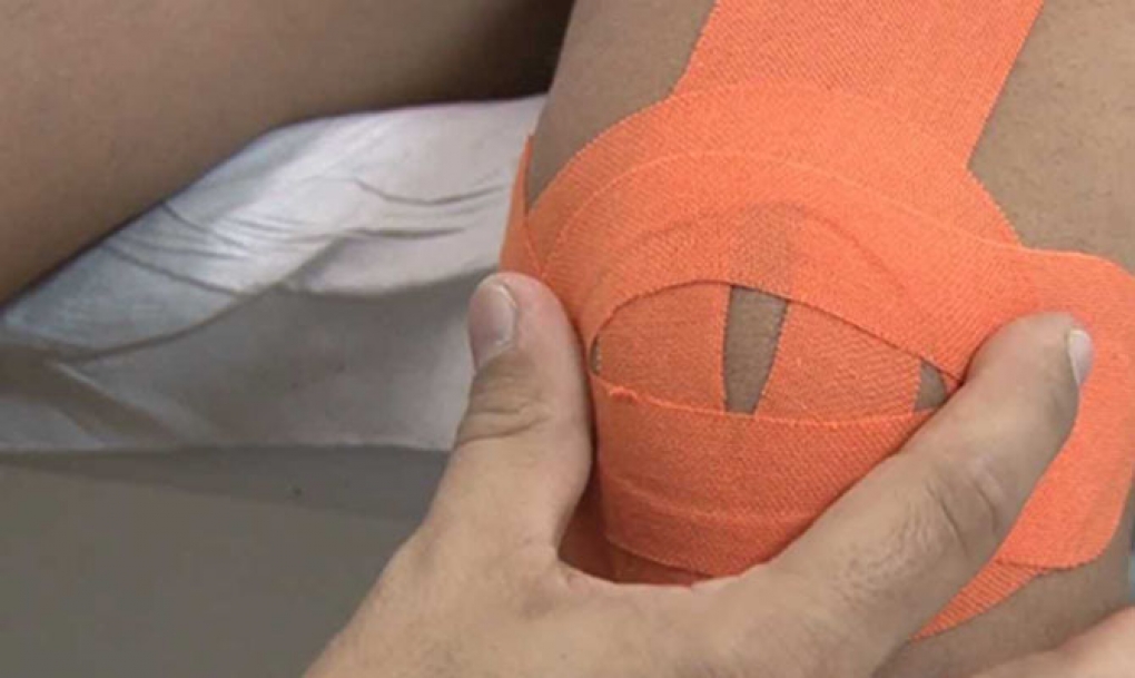 Los fisioterapeutas advierten que el uso indebido de las vendas de kinesioterapia puede producir problemas de salud