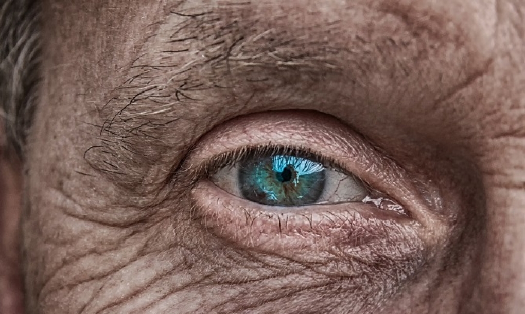 Llamada de atención de los ópticos a la mitad de los afectados por glaucoma que todavía desconocen su enfermedad