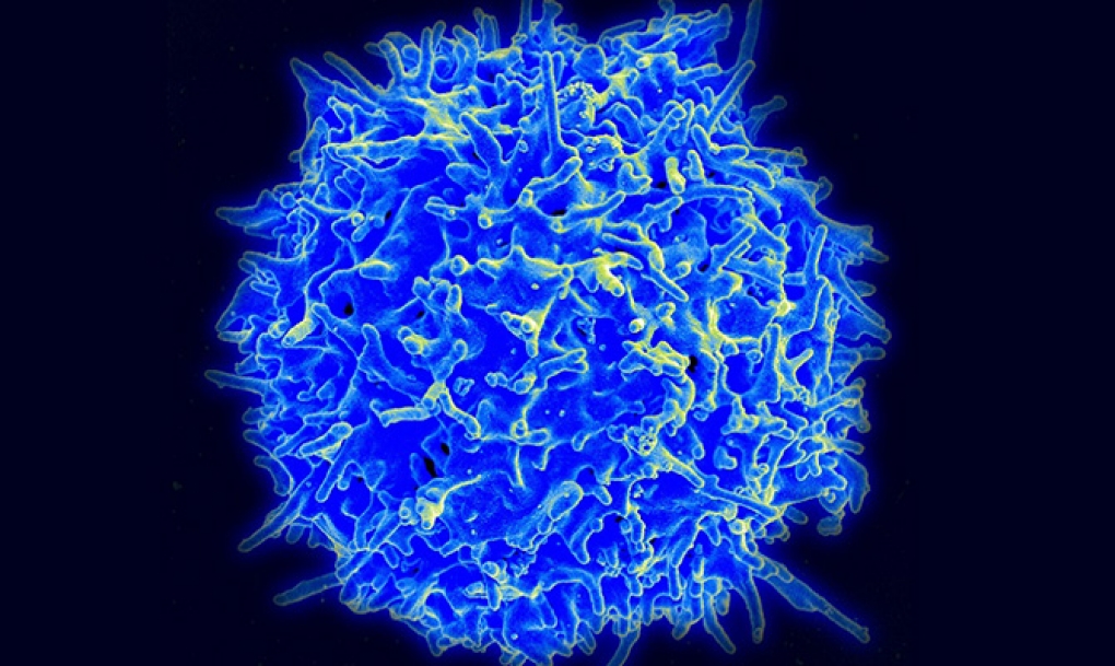 Un modelo matemático analiza cómo se reclutan linfocitos durante el desarrollo tumoral