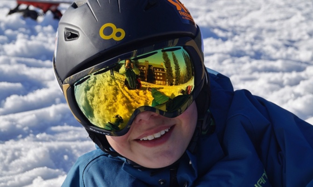 Una jornada de nieve sin la protección adecuada puede ser más dañina para nuestros ojos que un día de playa