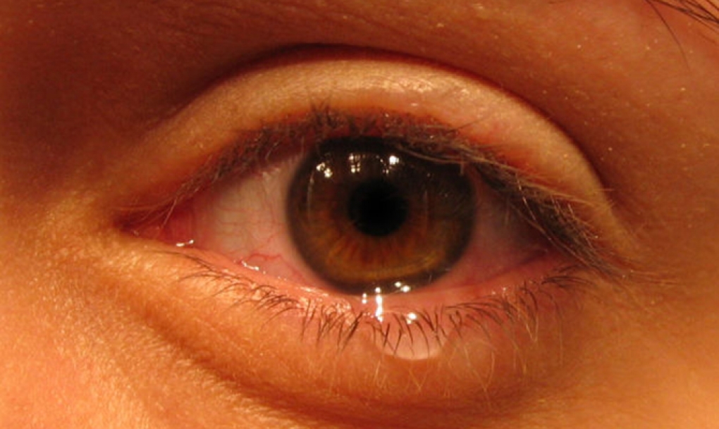 Los ópticos-optometristas recuerdan extremar la protección de los ojos frente a las alergias primaverales