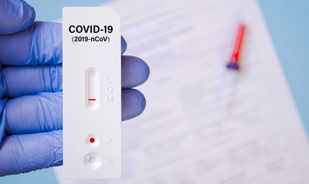 Castilla y León recuerda que los test rápidos de anticuerpos no sirven para saber si una persona tiene COVID-19 o si puede contagiar