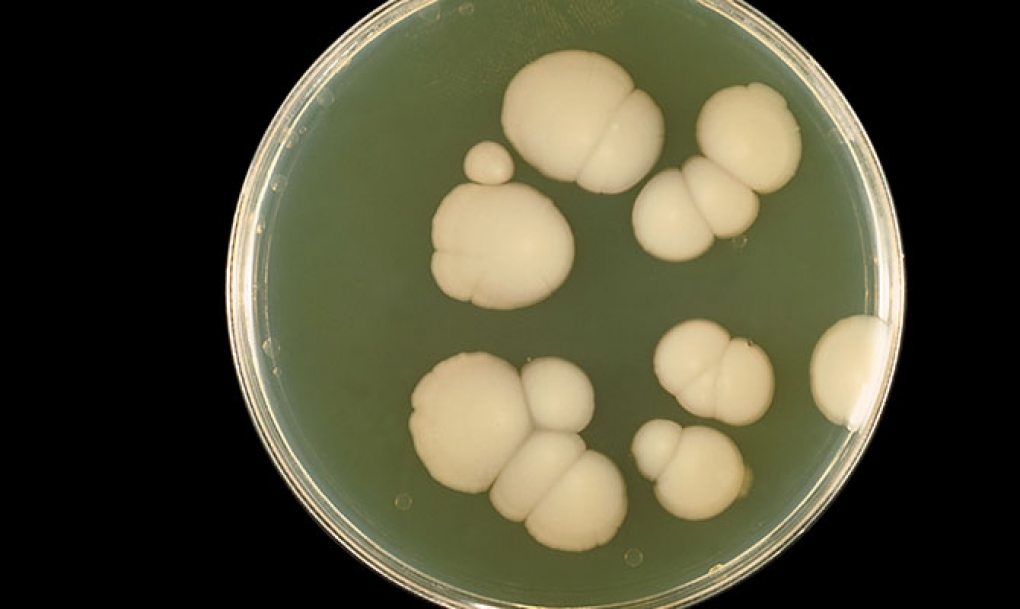 Premiada una investigación sobre un hongo peligroso para pacientes inmunodeprimidos
