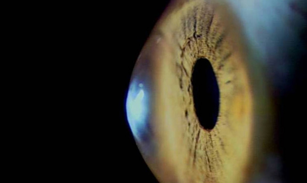 Científicos del CSIC desarrollan nuevas técnicas de imagen para el tratamiento de patologías oculares a la carta