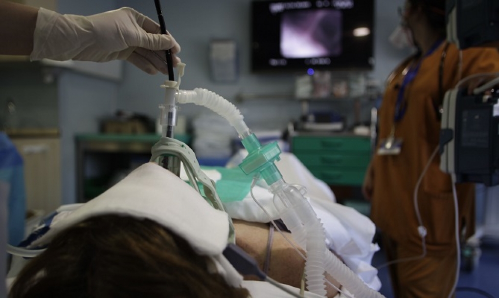 Cómo optimizar el tratamiento de los pacientes con daño grave en los pulmones después de la covid-19