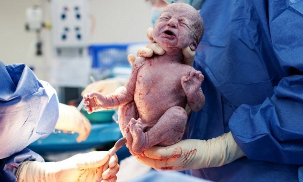Primer caso de transmisión del SARS-CoV-2 de madre a hijo a través de la placenta