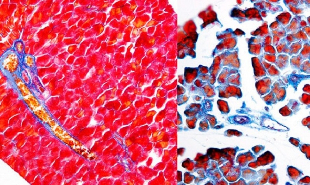 Revelan un nuevo mecanismo molecular implicado en la reparación pancreática