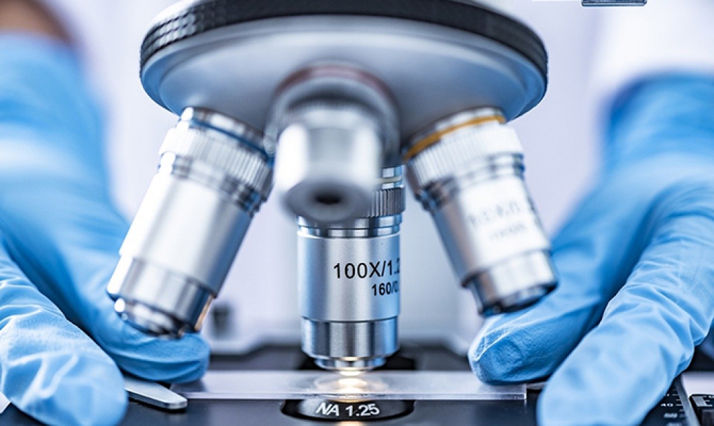 Las pruebas de laboratorio, cruciales para detectar y controlar la enfermedad renal crónica