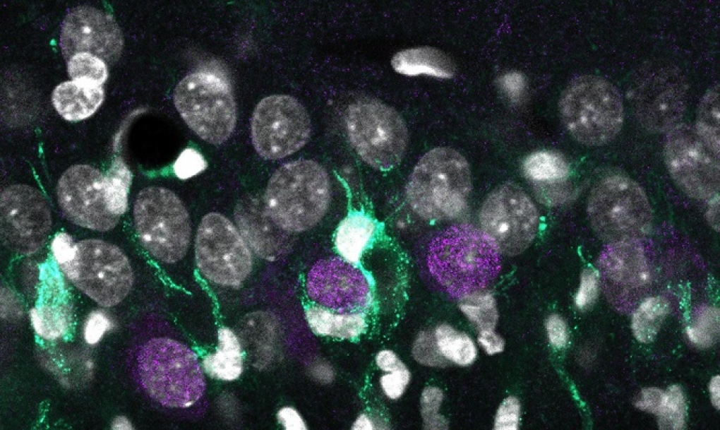 Un mapa genómico celular explica la muerte neuronal en la epilepsia