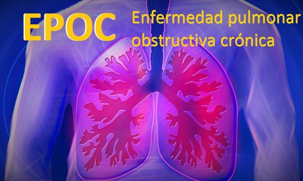 La progresión de la EPOC se asocia a una pérdida de la diversidad de la flora y más patógenos en los bronquios y pulmones